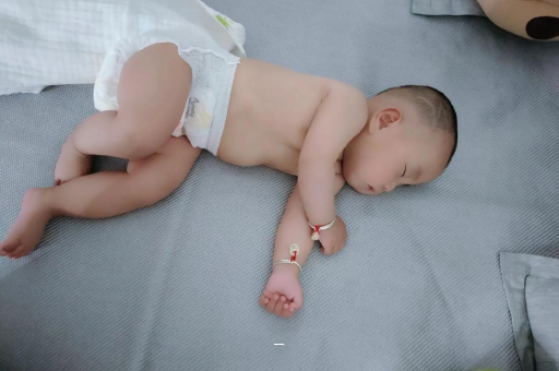 屯昌宝宝脸上有白色斑块